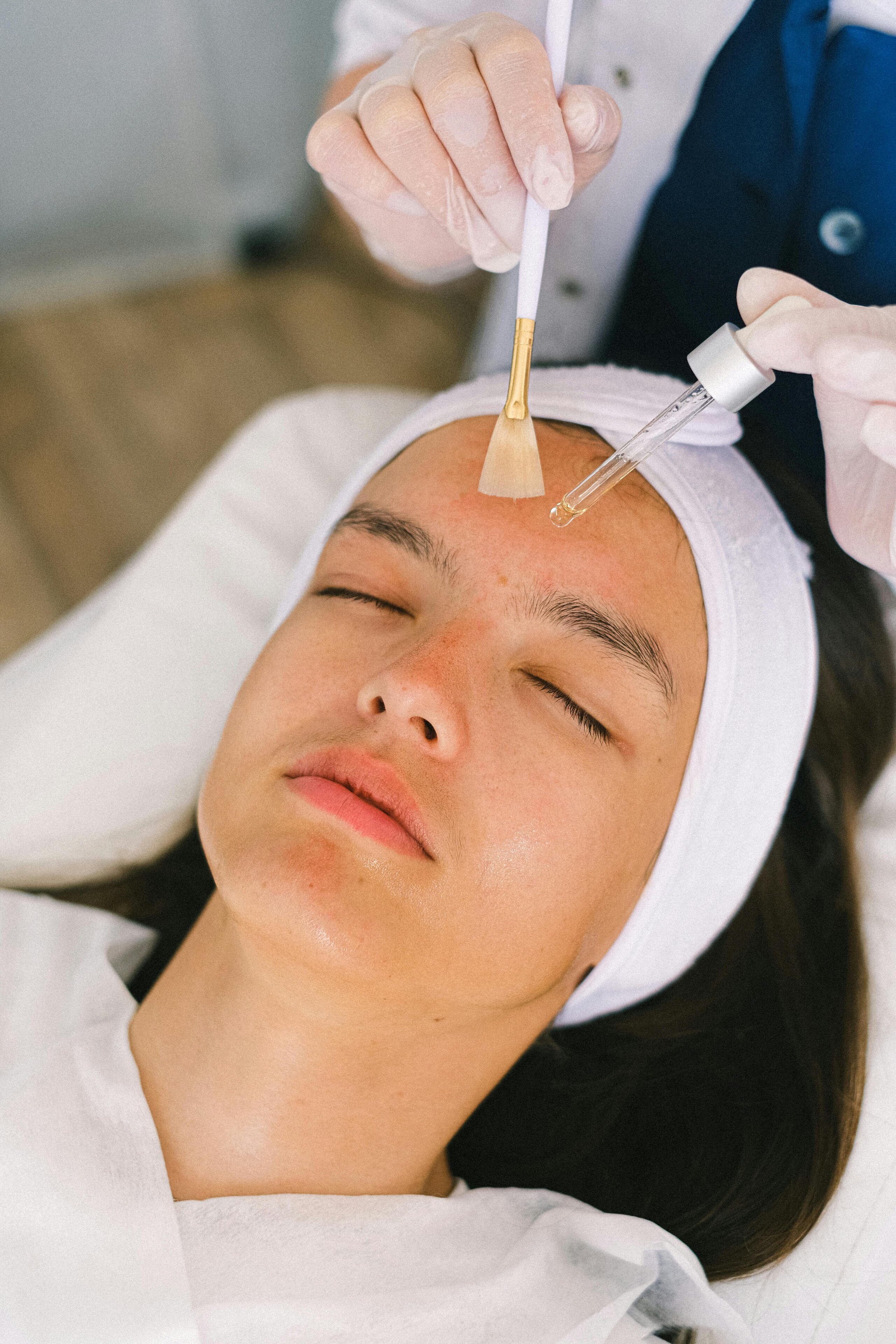 Professional applying chemical peel solution to a client’s face
