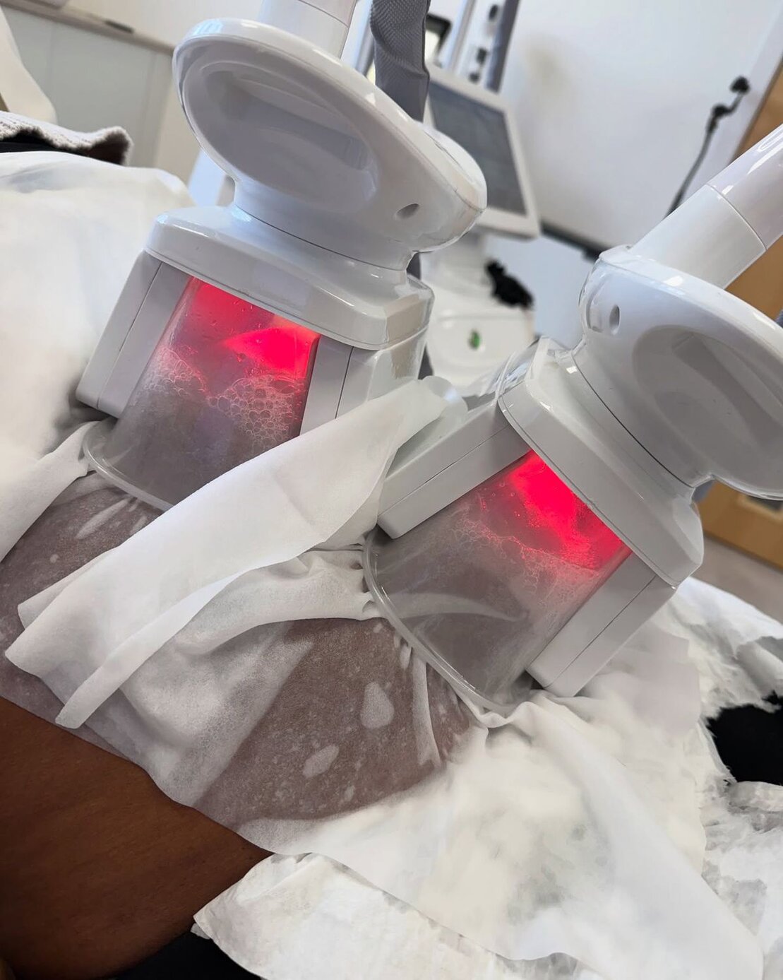 Non-invasive aesthetic equipment in a clinic room