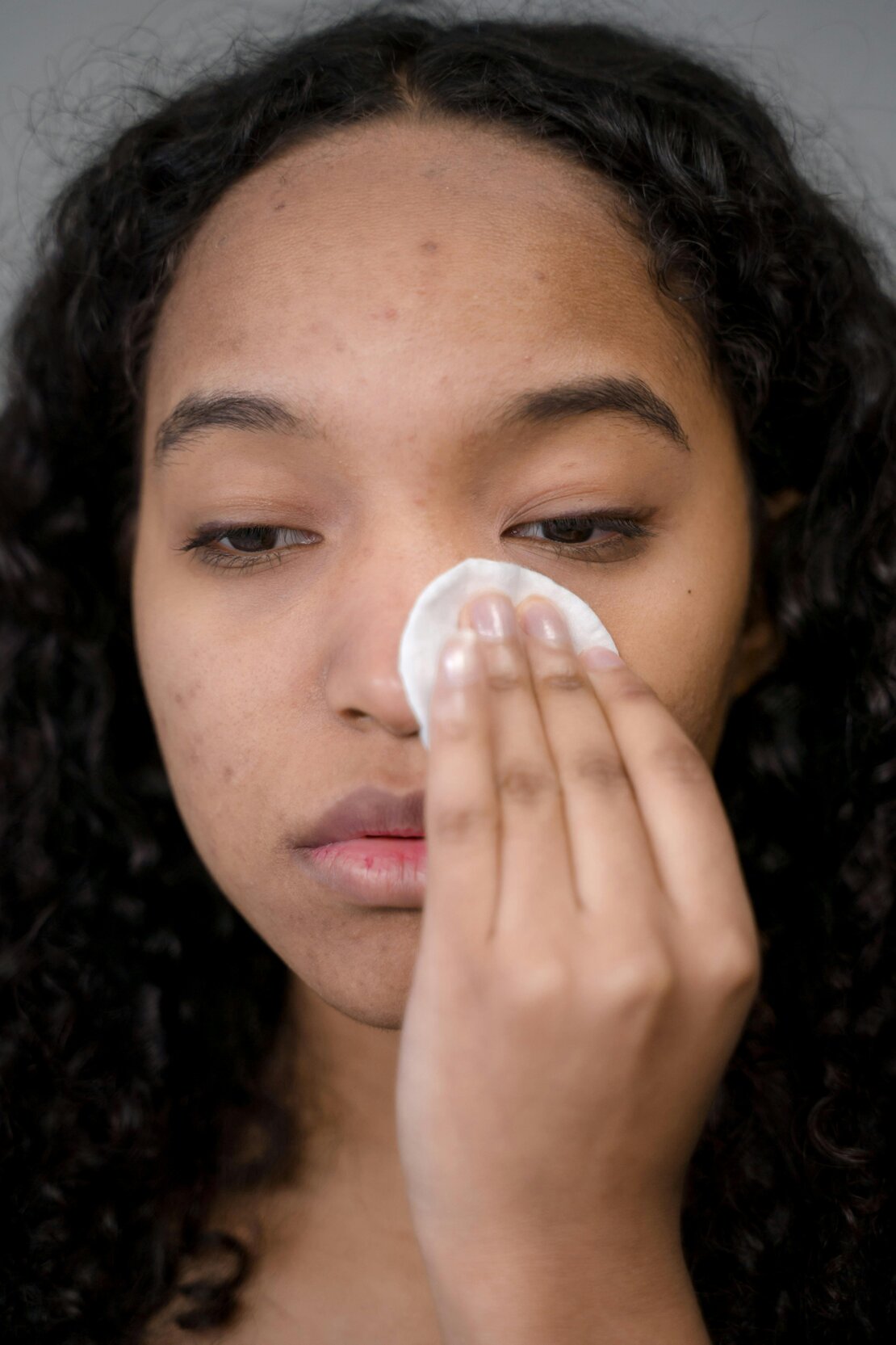Client receiving a professional acne facial treatment